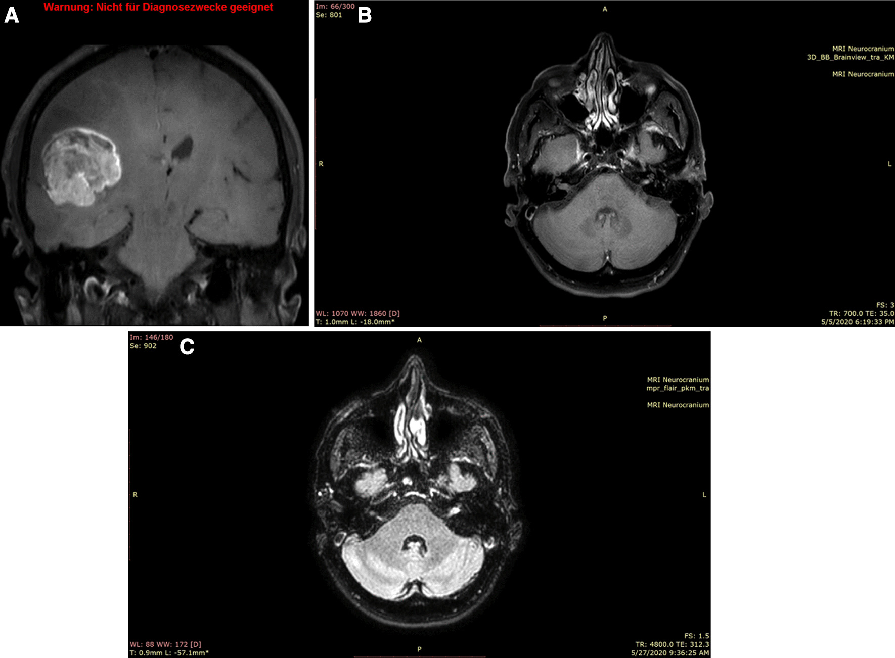 Key image 1