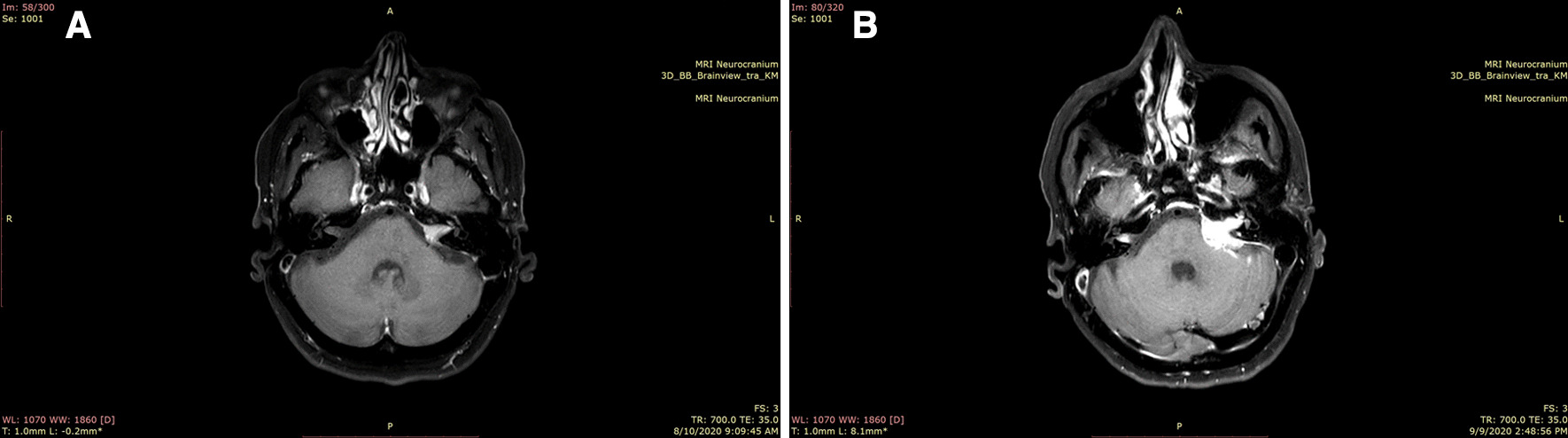 Key image 3