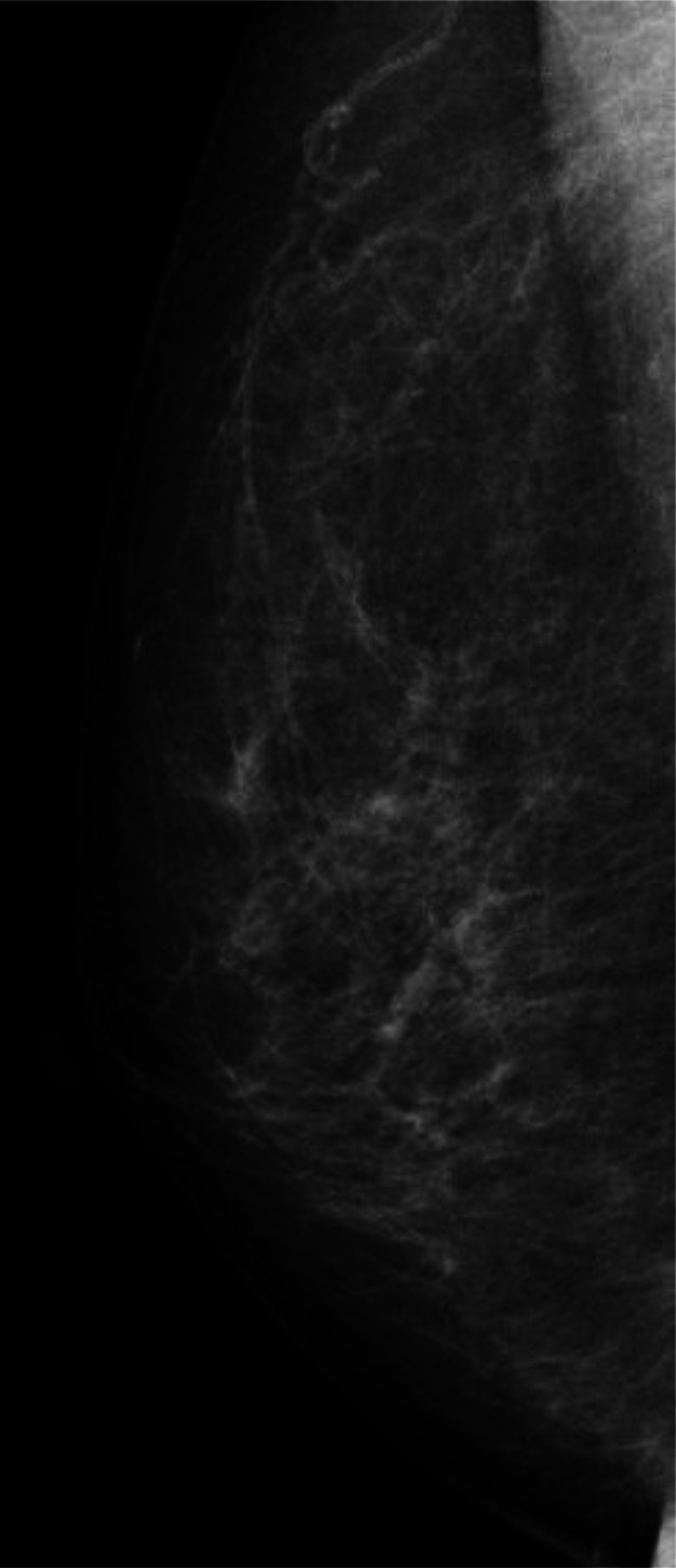 Key image 1