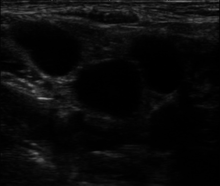 Key image 3