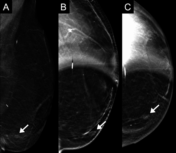 Key image 1