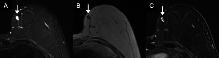 Key image 3