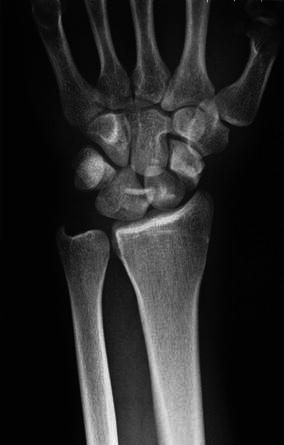 Key image 1