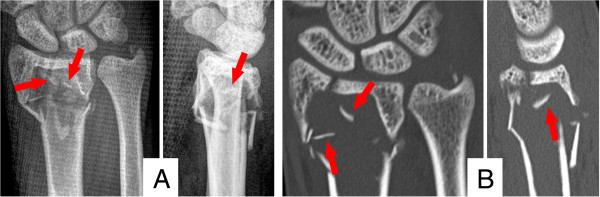 Key image 1