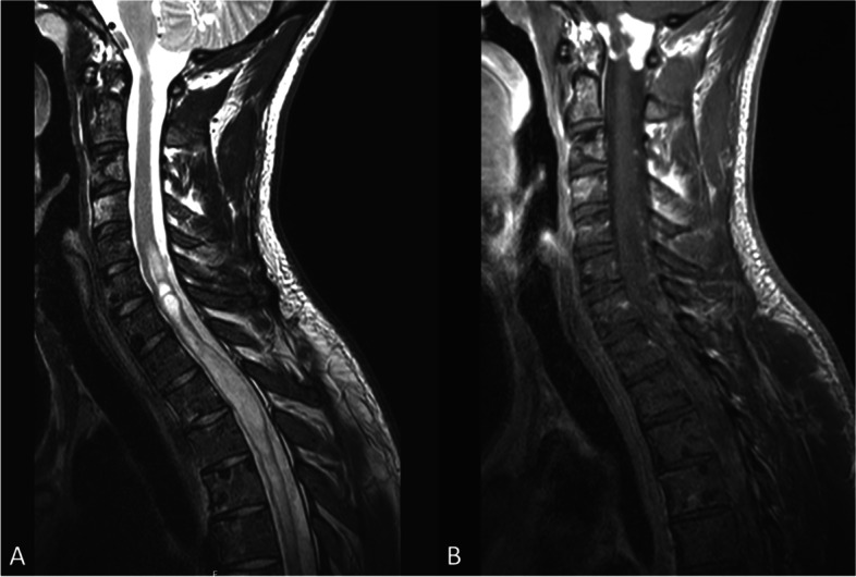 Key image 1
