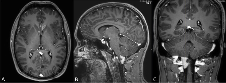 Key image 2