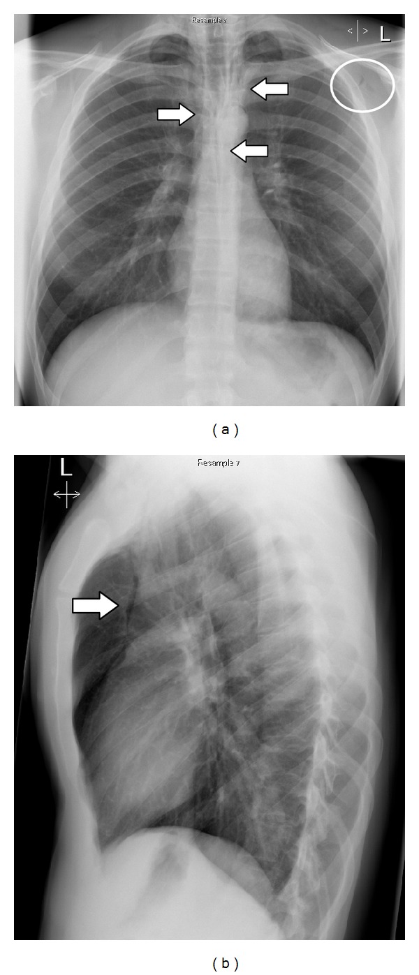 Key image 1