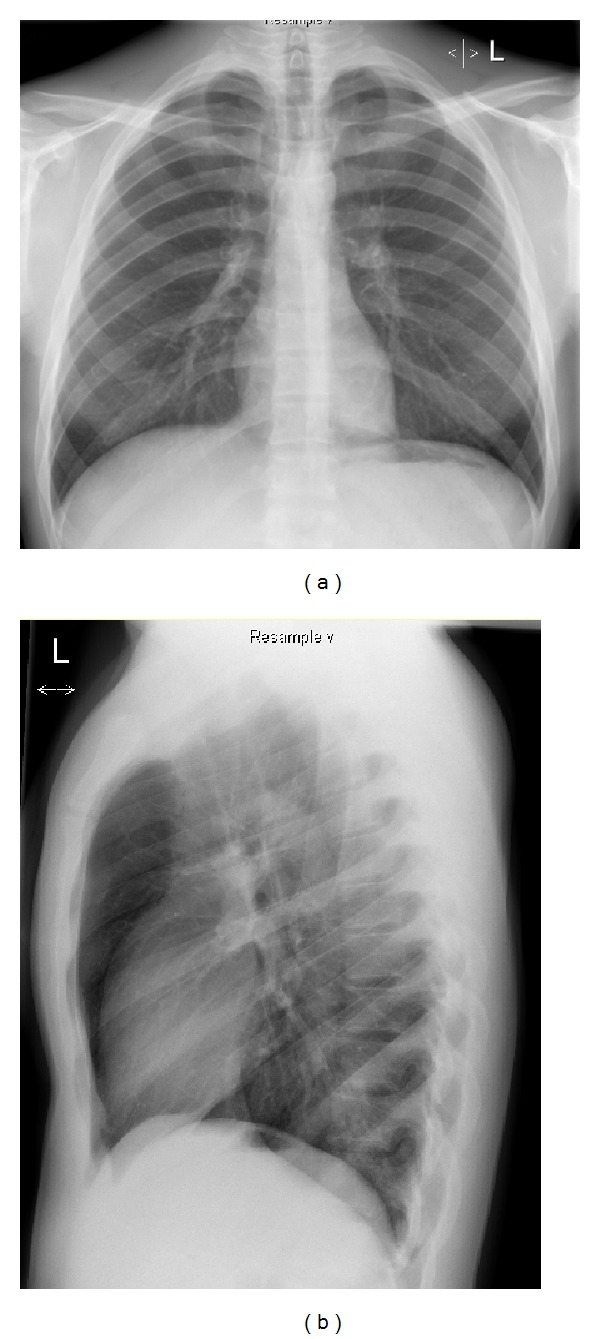 Key image 3