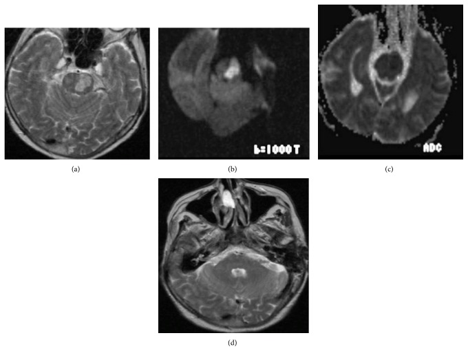 Key image 1