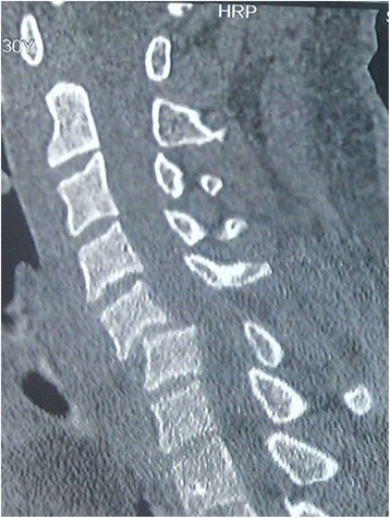 Key image 1