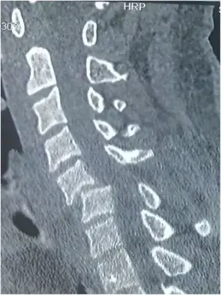 Key image 1