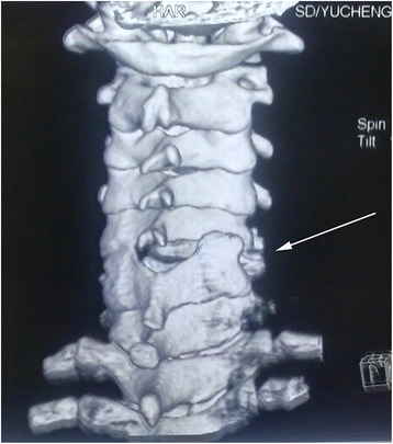 Key image 2