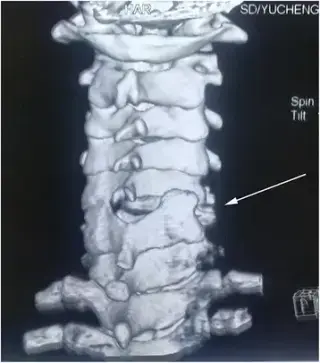 Key image 2