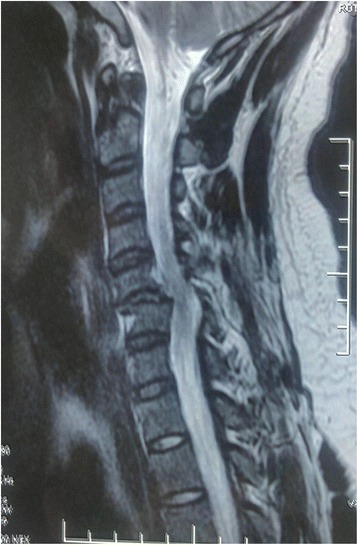 Key image 3