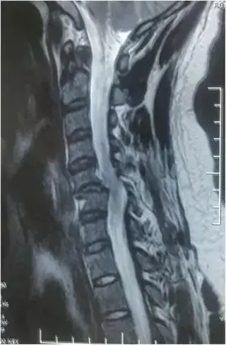 Key image 3