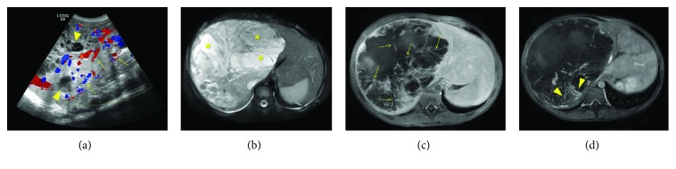 Key image 1