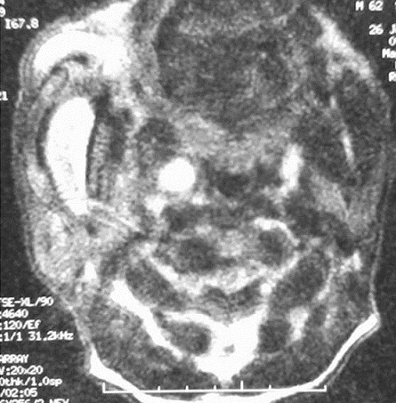 Key image 1