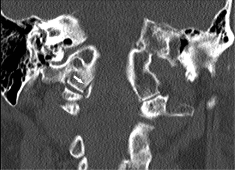 Key image 1