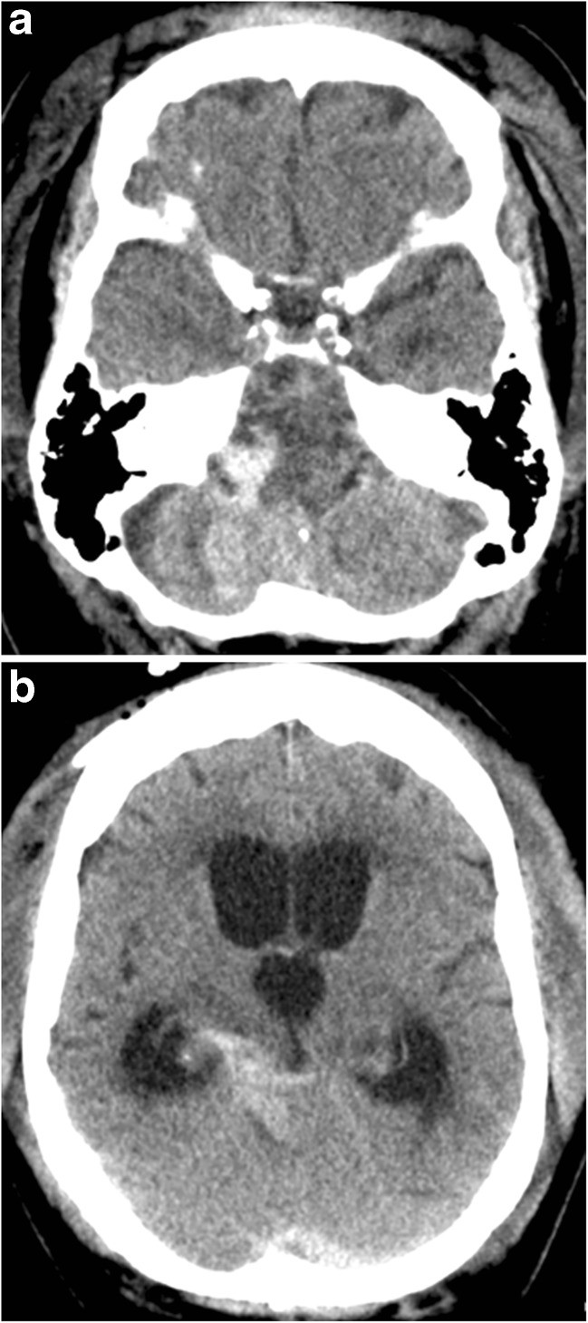 Key image 2