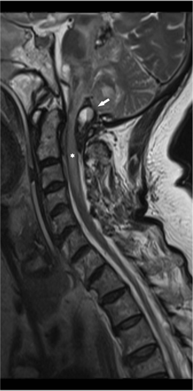 Key image 3