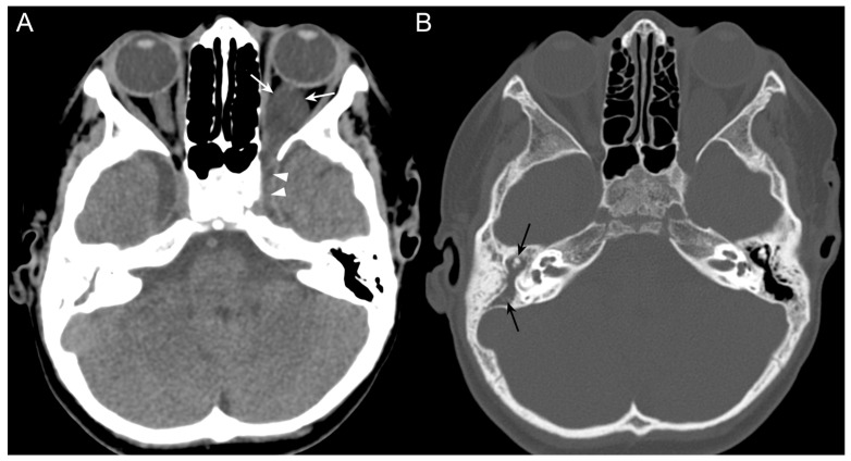 Key image 1