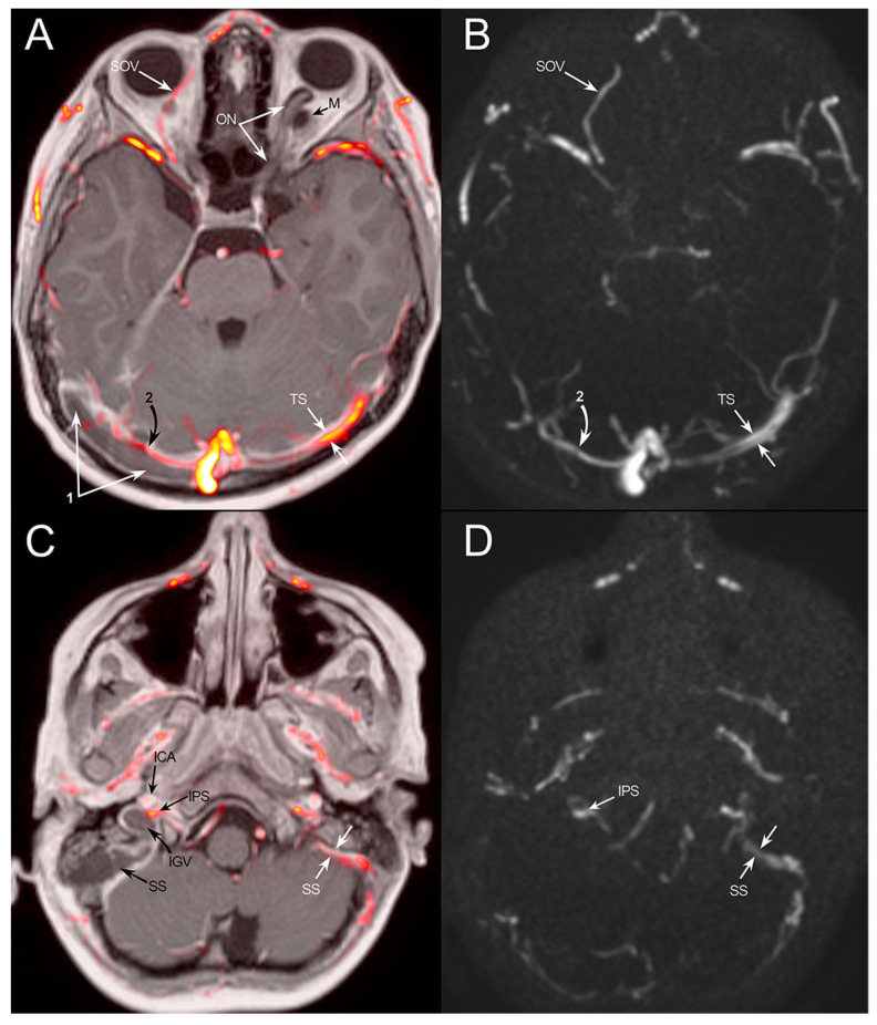 Key image 2