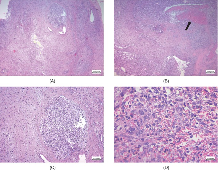 Key image 3