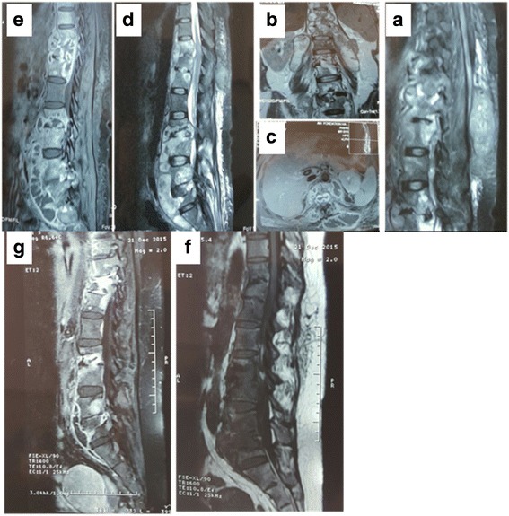 Key image 2