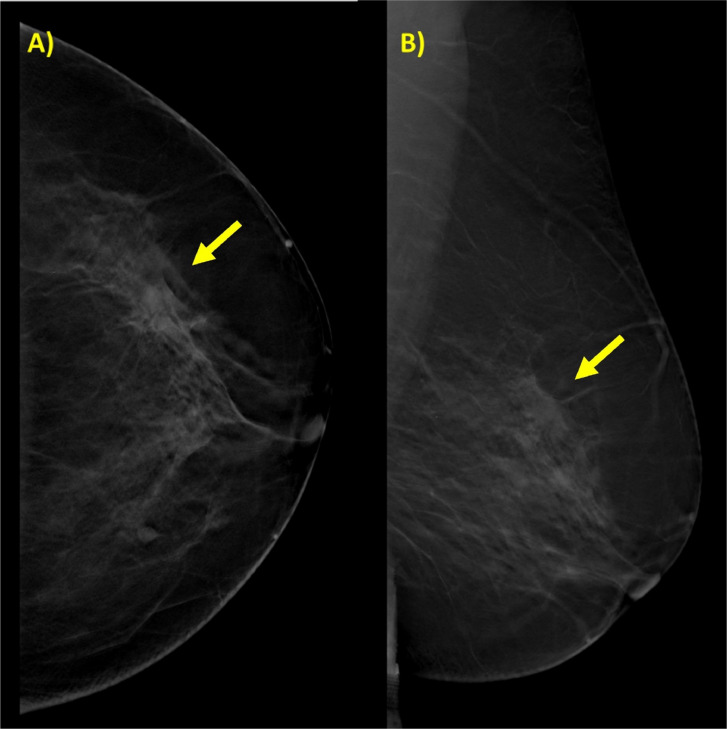 Key image 1
