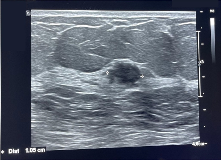 Key image 2