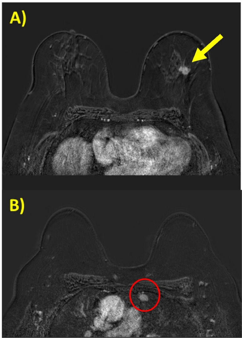 Key image 3