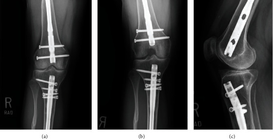 Key image 1