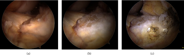 Key image 3
